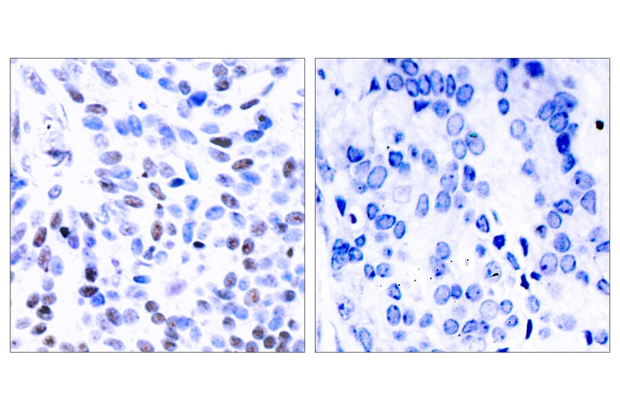 Immunohistochemistry - Anti-NF kappa B p100 / p52 Antibody (B7164) - Antibodies.com