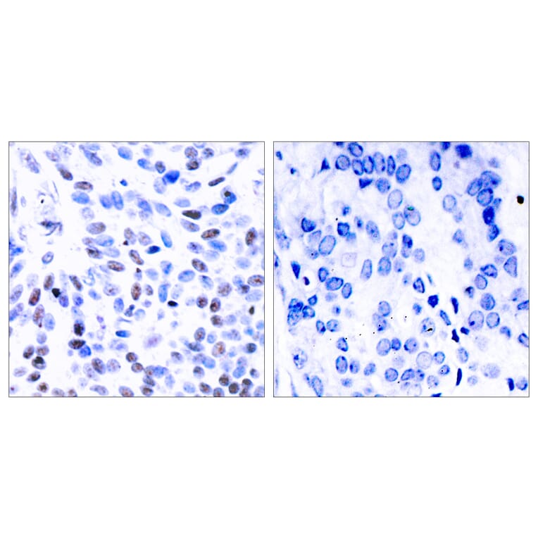 Immunohistochemistry - Anti-NF kappa B p100 / p52 Antibody (B7164) - Antibodies.com