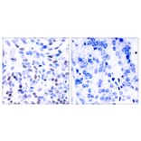 Immunohistochemistry - Anti-NF kappa B p100 / p52 Antibody (B7164) - Antibodies.com