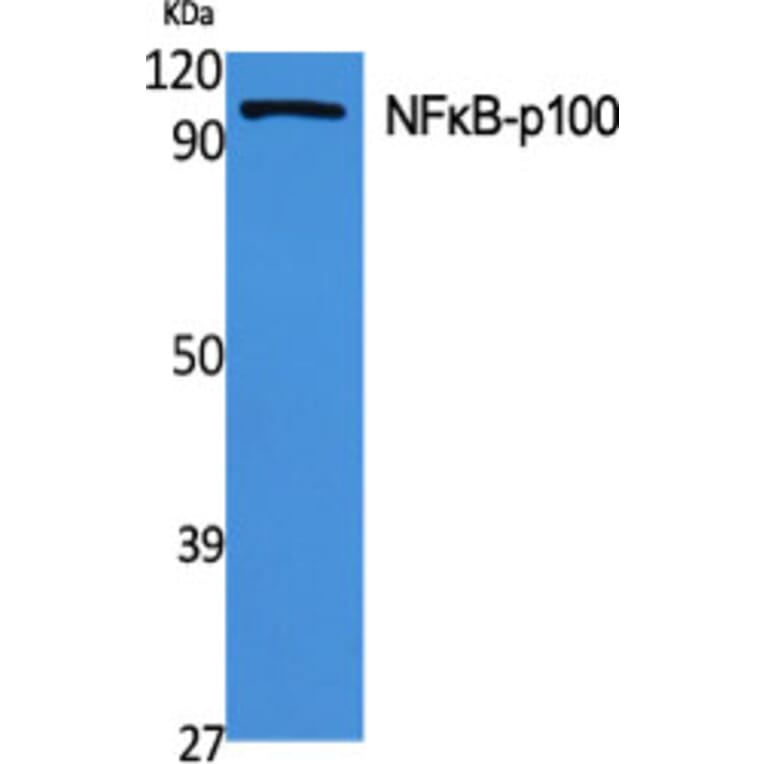 Western Blot - Anti-NF kappa B p100 / p52 Antibody (B7164) - Antibodies.com