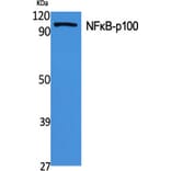 Western Blot - Anti-NF kappa B p100 / p52 Antibody (B7164) - Antibodies.com