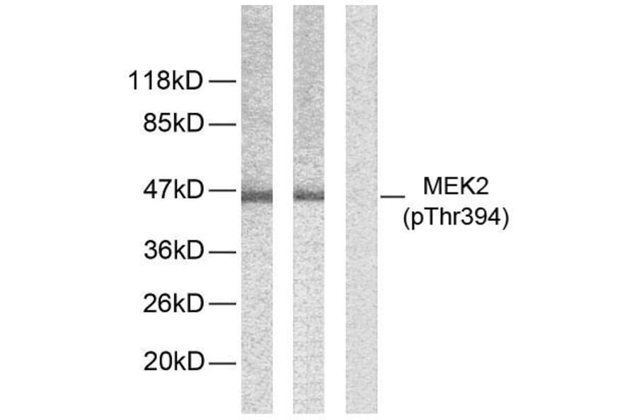 Western Blot - Anti-MEK2 (phospho Thr394) Antibody (A7149) - Antibodies.com