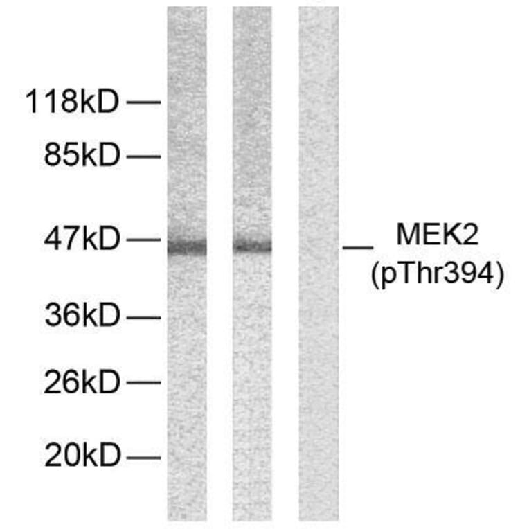 Western Blot - Anti-MEK2 (phospho Thr394) Antibody (A7149) - Antibodies.com