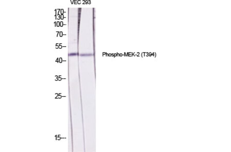 Western Blot - Anti-MEK2 (phospho Thr394) Antibody (A7149) - Antibodies.com