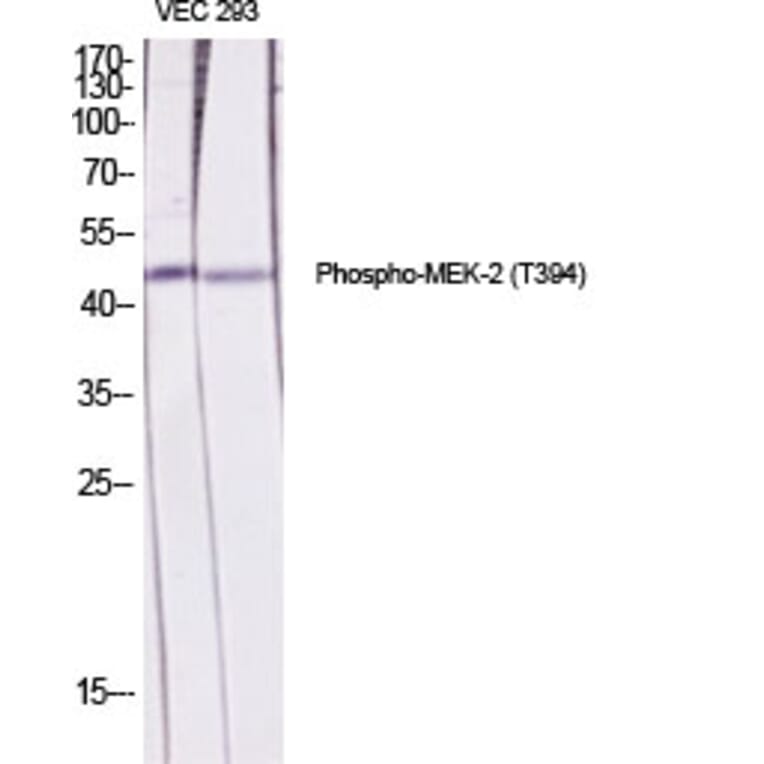 Western Blot - Anti-MEK2 (phospho Thr394) Antibody (A7149) - Antibodies.com