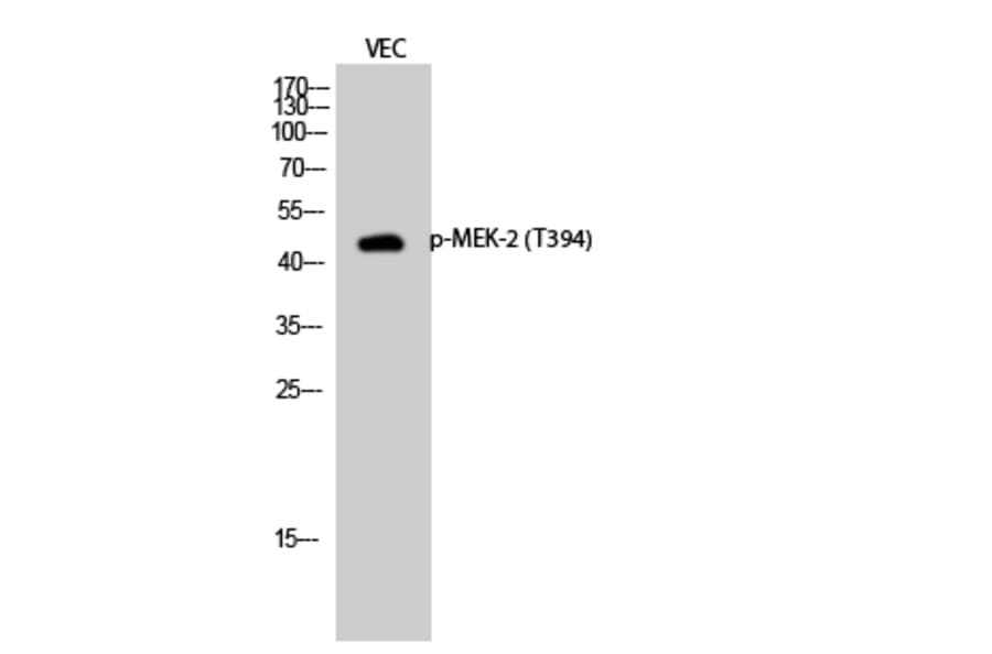 Western Blot - Anti-MEK2 (phospho Thr394) Antibody (A7149) - Antibodies.com