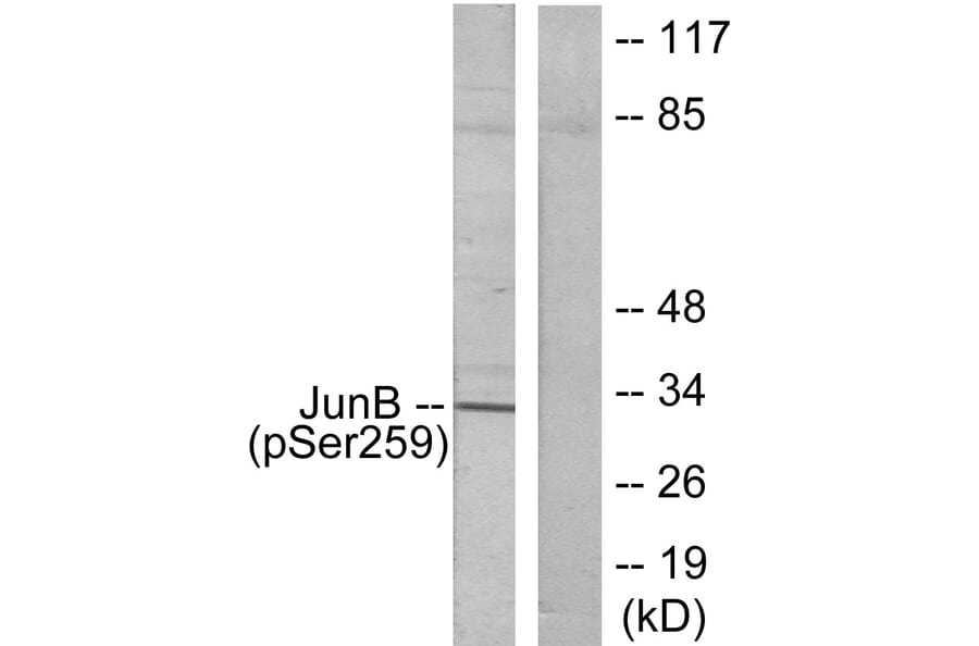 Western Blot - Anti-JunB (phospho Ser259) Antibody (A7135) - Antibodies.com