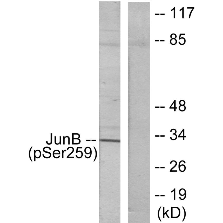 Western Blot - Anti-JunB (phospho Ser259) Antibody (A7135) - Antibodies.com