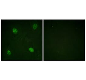 Immunofluorescence - Anti-hnRPD (phospho Ser83) Antibody (A1043) - Antibodies.com