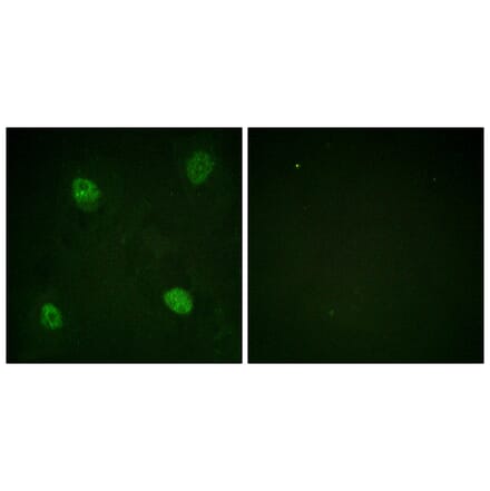 Immunofluorescence - Anti-hnRPD (phospho Ser83) Antibody (A1043) - Antibodies.com