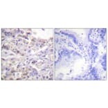 Immunohistochemistry - Anti-hnRPD (phospho Ser83) Antibody (A1043) - Antibodies.com
