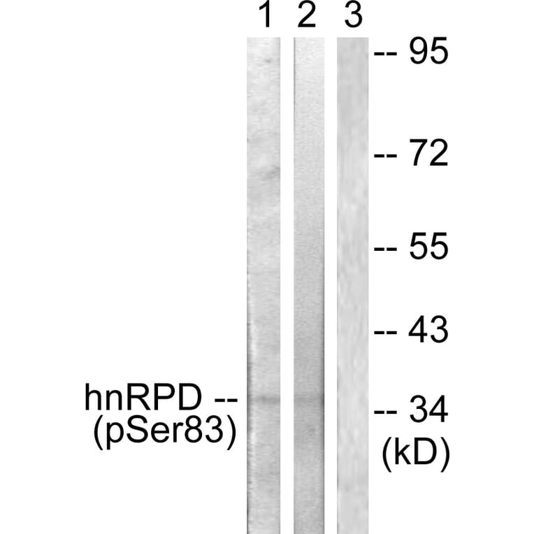 Western Blot - Anti-hnRPD (phospho Ser83) Antibody (A1043) - Antibodies.com