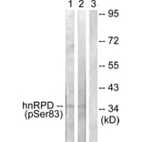 Western Blot - Anti-hnRPD (phospho Ser83) Antibody (A1043) - Antibodies.com
