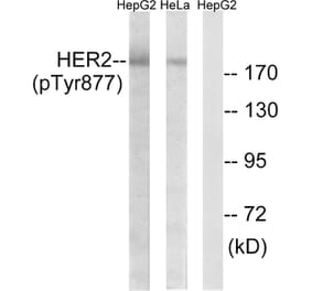 Western Blot - Anti-HER2 (phospho Tyr877) Antibody (A7105) - Antibodies.com