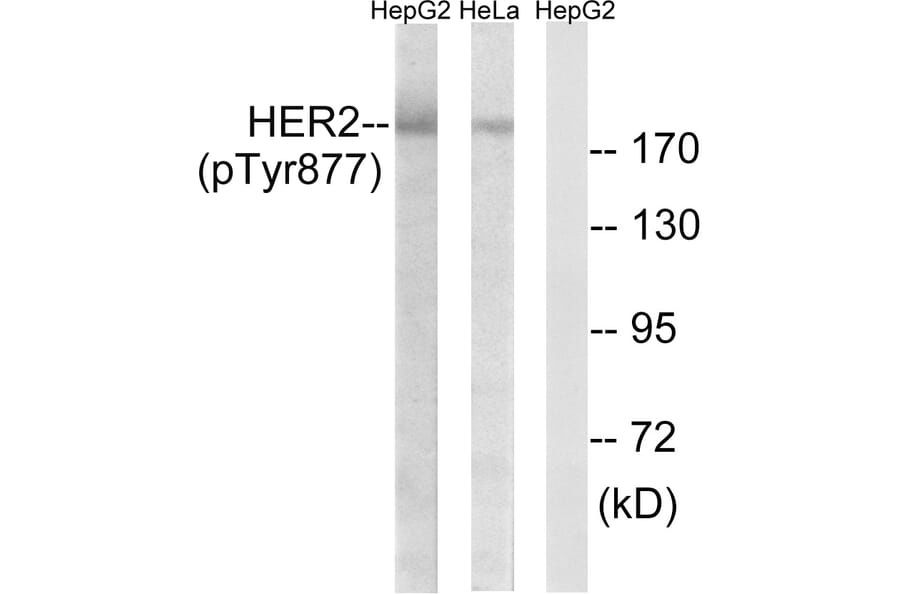 Western Blot - Anti-HER2 (phospho Tyr877) Antibody (A7105) - Antibodies.com