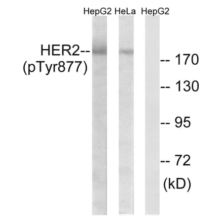 Western Blot - Anti-HER2 (phospho Tyr877) Antibody (A7105) - Antibodies.com