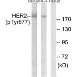 Western Blot - Anti-HER2 (phospho Tyr877) Antibody (A7105) - Antibodies.com