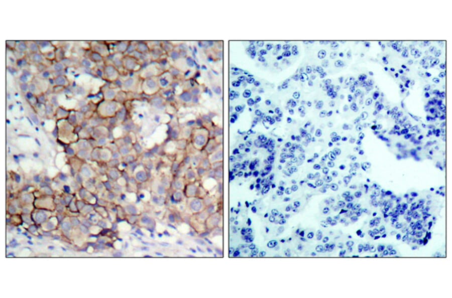 Immunohistochemistry - Anti-HER2 (phospho Tyr877) Antibody (A7105) - Antibodies.com
