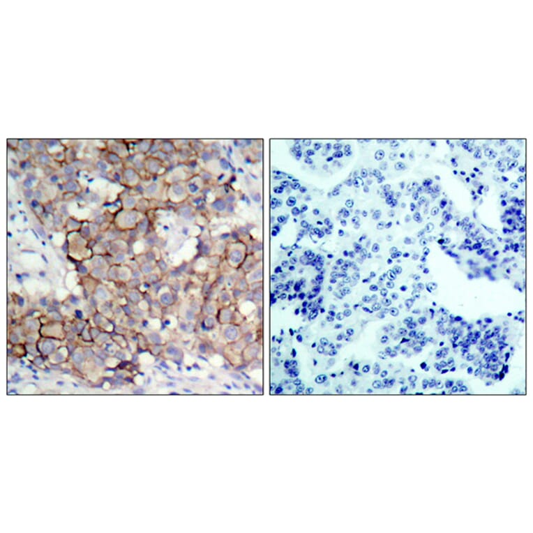 Immunohistochemistry - Anti-HER2 (phospho Tyr877) Antibody (A7105) - Antibodies.com