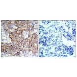 Immunohistochemistry - Anti-HER2 (phospho Tyr877) Antibody (A7105) - Antibodies.com