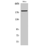 Western Blot - Anti-HER2 (phospho Tyr877) Antibody (A7105) - Antibodies.com