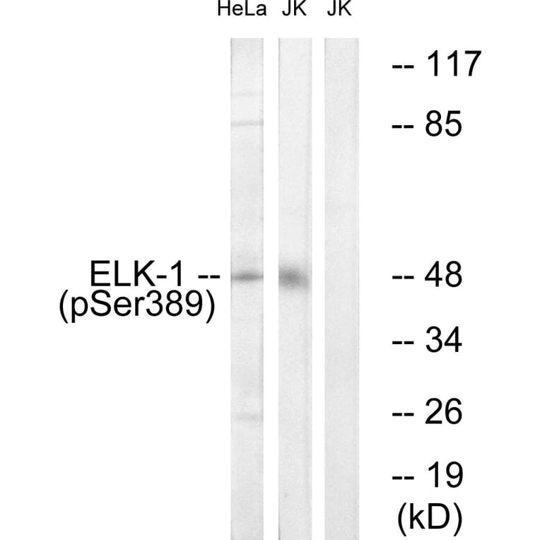 Western Blot - Anti-Elk1 (phospho Ser389) Antibody (A7069) - Antibodies.com