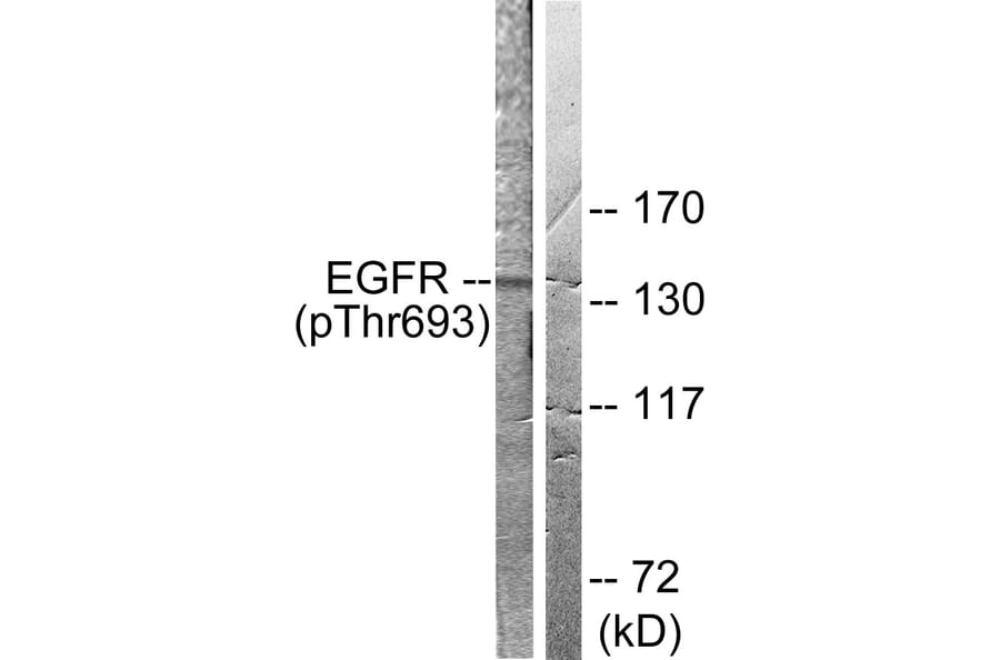 Western Blot - Anti-EGFR (phospho Thr693) Antibody (A0009) - Antibodies.com