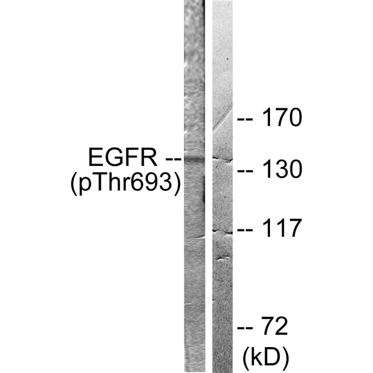 Western Blot - Anti-EGFR (phospho Thr693) Antibody (A0009) - Antibodies.com