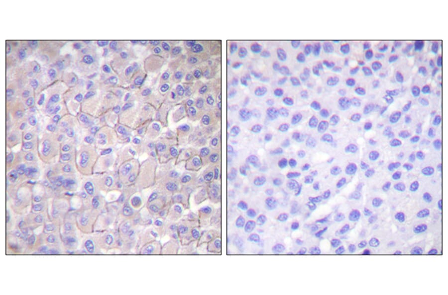 Immunohistochemistry - Anti-EGFR (phospho Thr693) Antibody (A0009) - Antibodies.com