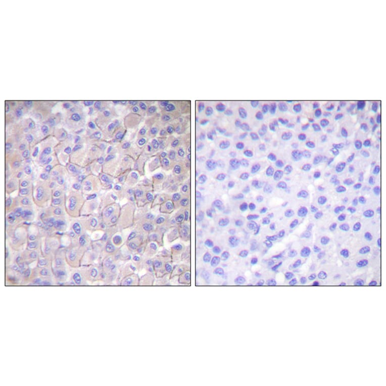 Immunohistochemistry - Anti-EGFR (phospho Thr693) Antibody (A0009) - Antibodies.com