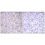 Immunohistochemistry - Anti-EGFR (phospho Thr693) Antibody (A0009) - Antibodies.com