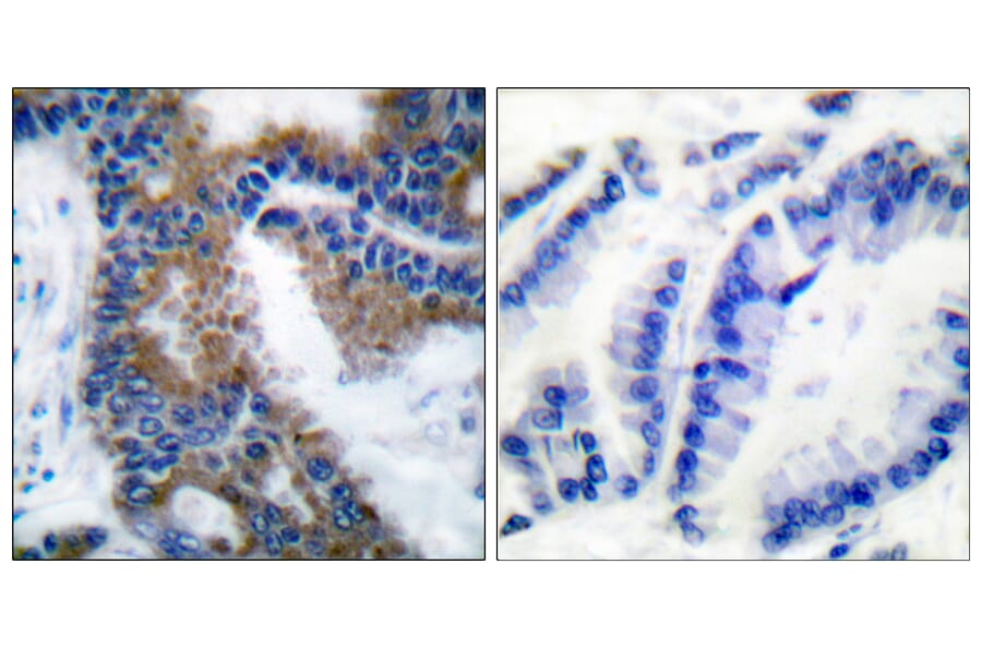Immunohistochemistry - Anti-CrkL (phospho Tyr207) Antibody (A0067) - Antibodies.com