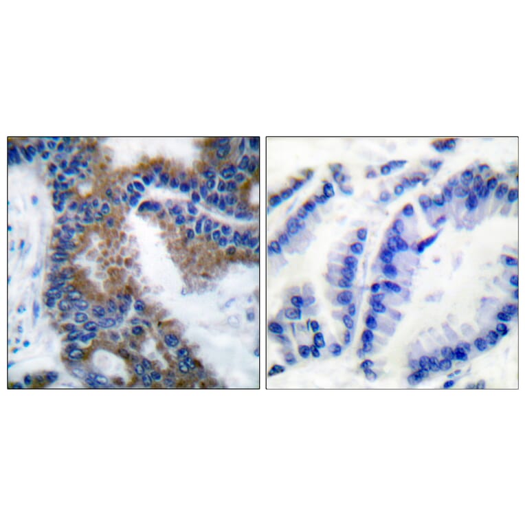 Immunohistochemistry - Anti-CrkL (phospho Tyr207) Antibody (A0067) - Antibodies.com