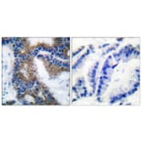 Immunohistochemistry - Anti-CrkL (phospho Tyr207) Antibody (A0067) - Antibodies.com