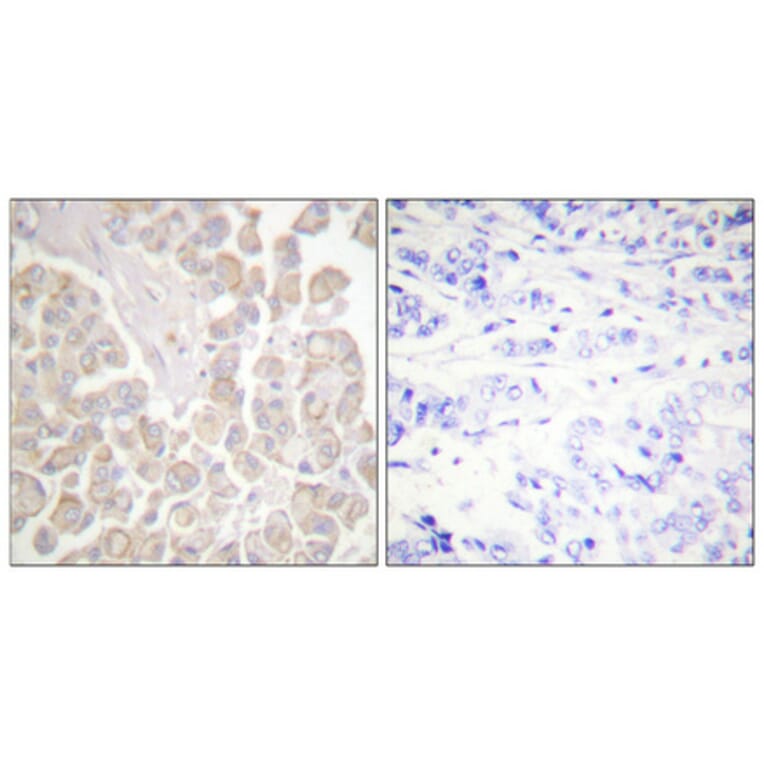 Immunohistochemistry - Anti-CrkL (phospho Tyr207) Antibody (A0067) - Antibodies.com