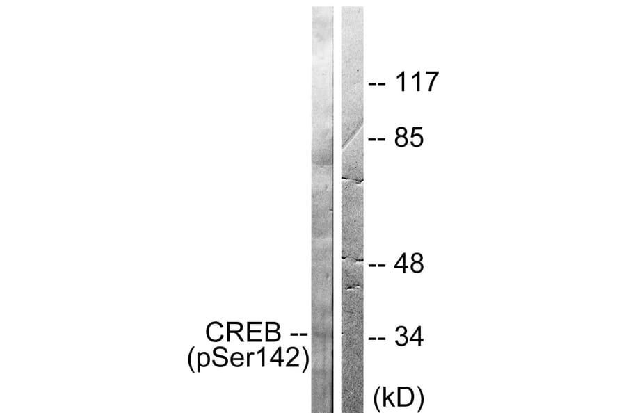Western Blot - Anti-CREB (phospho Ser142) Antibody (A0006) - Antibodies.com