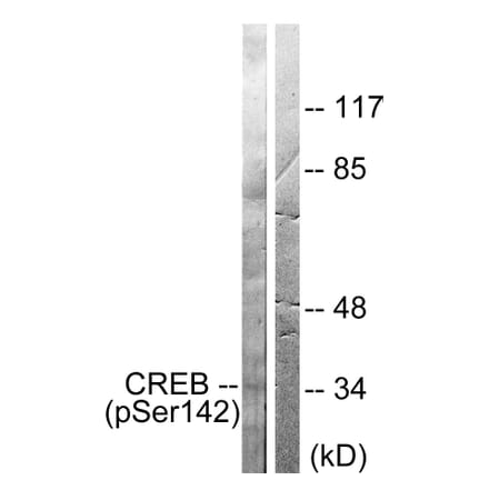 Western Blot - Anti-CREB (phospho Ser142) Antibody (A0006) - Antibodies.com