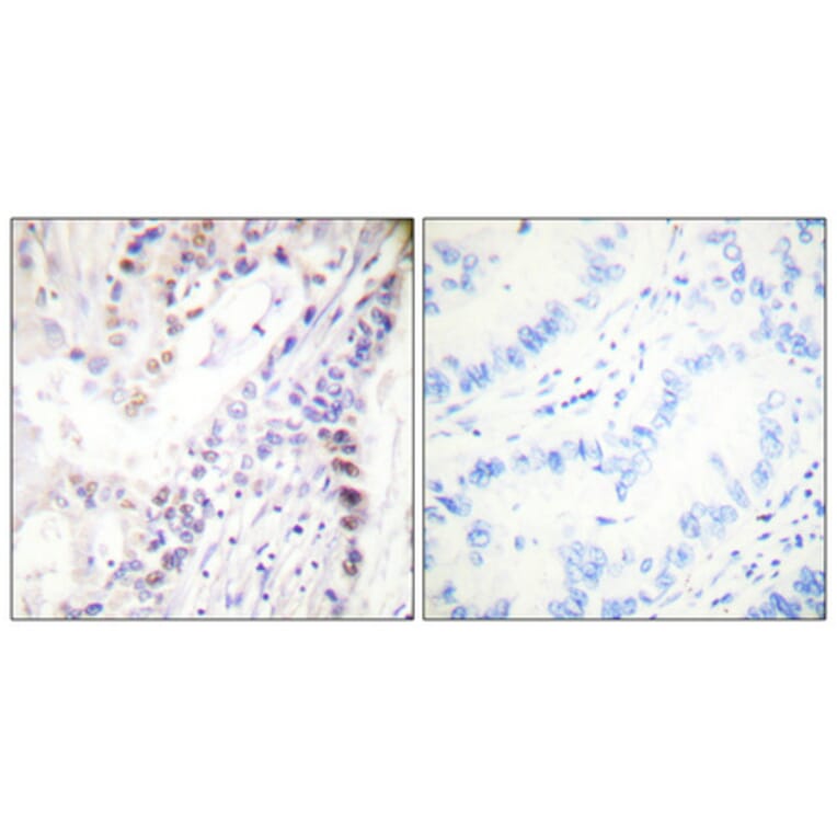 Immunohistochemistry - Anti-CREB (phospho Ser142) Antibody (A0006) - Antibodies.com
