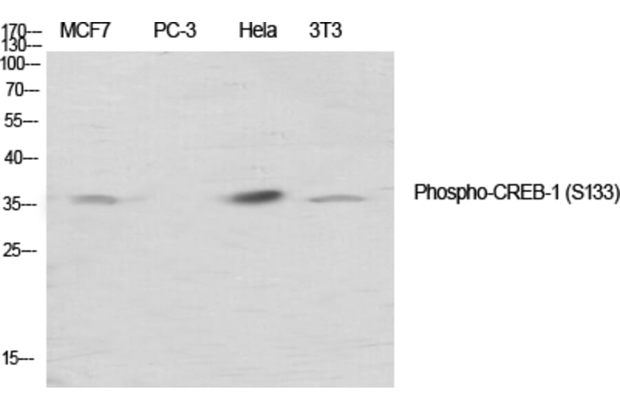 Immunohistochemistry - Anti-CREB (phospho Ser133) Antibody (A7053) - Antibodies.com