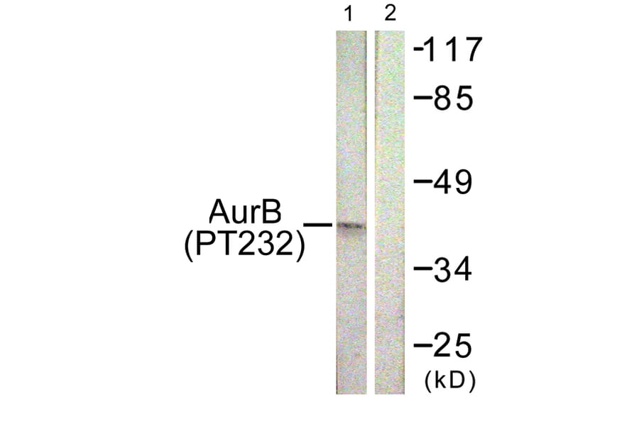 Western Blot - Anti-AurB (phospho Thr232) Antibody (A1021) - Antibodies.com