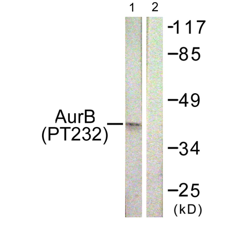 Western Blot - Anti-AurB (phospho Thr232) Antibody (A1021) - Antibodies.com