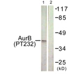 Western Blot - Anti-AurB (phospho Thr232) Antibody (A1021) - Antibodies.com