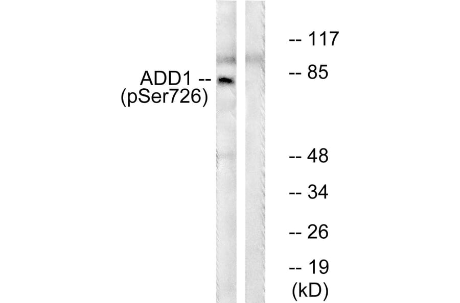 Western Blot - Anti-ADD1 (phospho Ser726) Antibody (A0002) - Antibodies.com