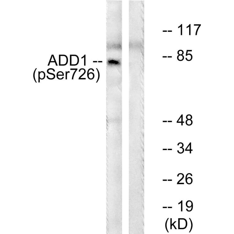 Western Blot - Anti-ADD1 (phospho Ser726) Antibody (A0002) - Antibodies.com