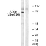 Western Blot - Anti-ADD1 (phospho Ser726) Antibody (A0002) - Antibodies.com