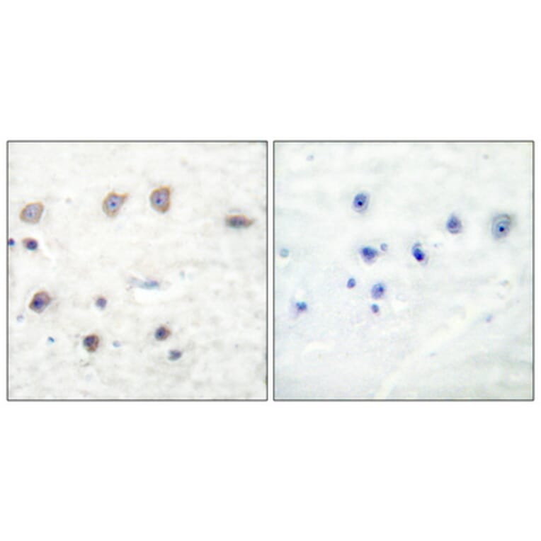 Immunohistochemistry - Anti-ADD1 (phospho Ser726) Antibody (A0002) - Antibodies.com