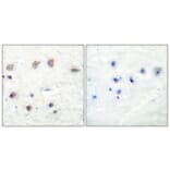 Immunohistochemistry - Anti-ADD1 (phospho Ser726) Antibody (A0002) - Antibodies.com