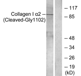 Western Blot - Anti-Collagen I alpha2 (cleaved Gly1102) Antibody (L0220) - Antibodies.com