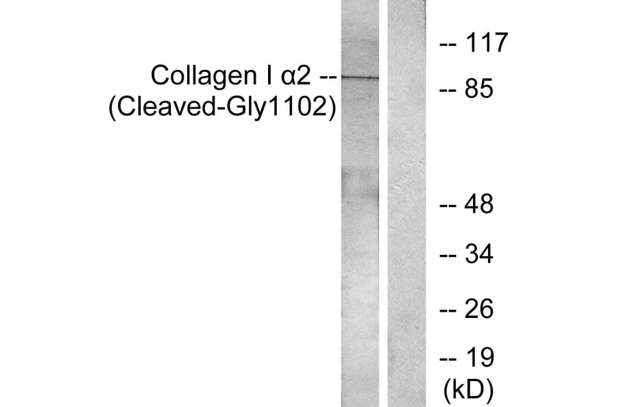 Western Blot - Anti-Collagen I alpha2 (cleaved Gly1102) Antibody (L0220) - Antibodies.com