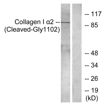 Western Blot - Anti-Collagen I alpha2 (cleaved Gly1102) Antibody (L0220) - Antibodies.com